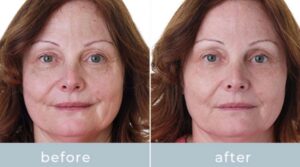 81a8da99-baa4-4bbd-9c7b-3c8dc6ccd91a